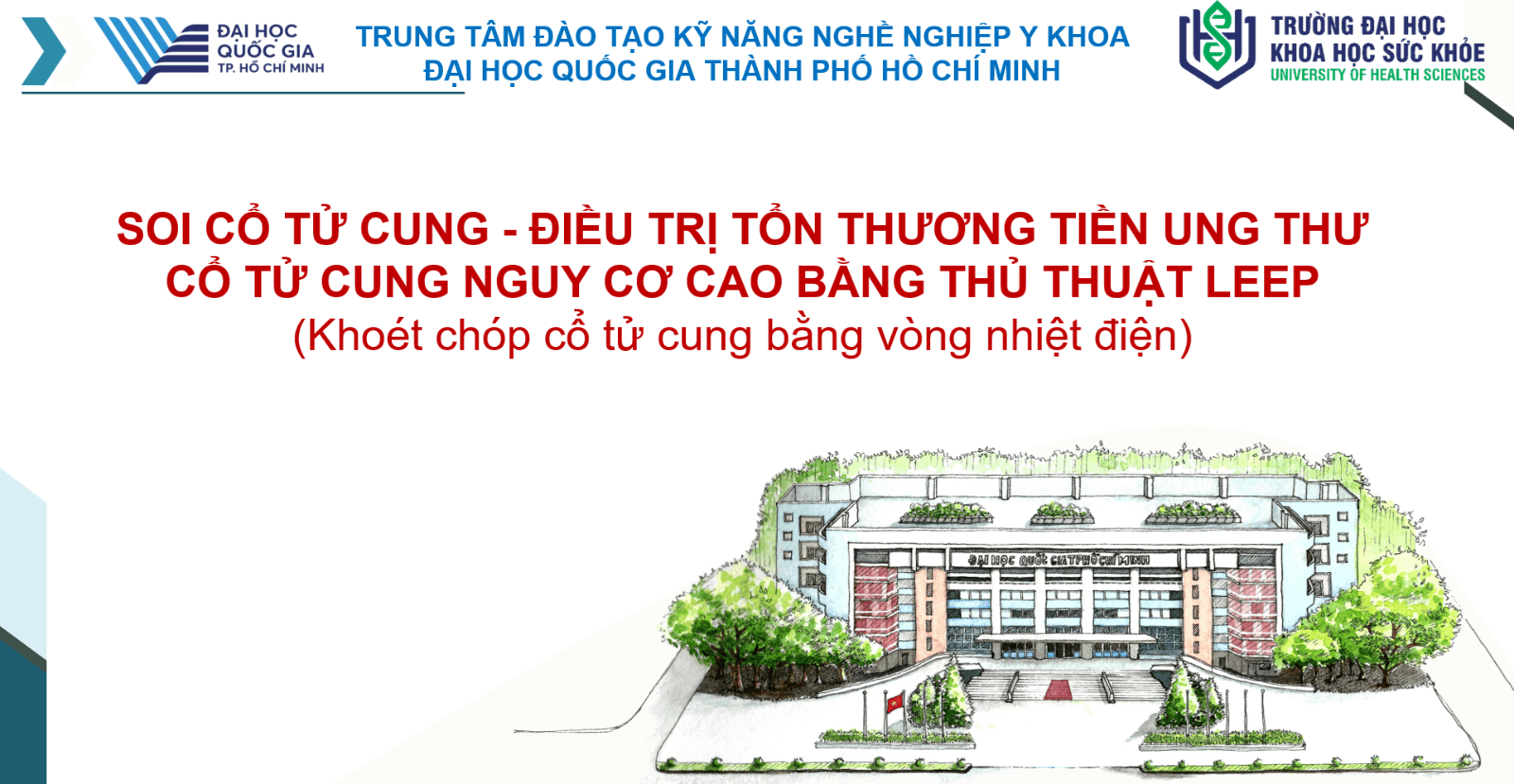 SOI CỔ TỬ CUNG - ĐIỀU TRỊ TỔN THƯƠNG TIỀN UNG THƯ CỔ TỬ CUNG NGUY CƠ CAO BẰNG THỦ THUẬT KHOÉT CHÓP CỔ TỬ CUNG BẰNG VÒNG NHIỆT ĐIỆN (LEEP - LOOP ELECTROSURGICAL EXCISION PROCEDURE)